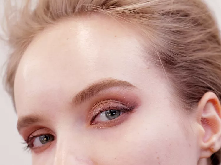 Milia - small white bumps around the eyes
