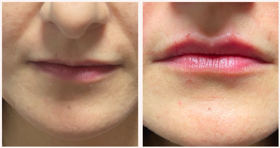 Screenshot 2025-09-22 144432