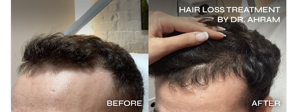 ne york hair treatment hair regorwth and hair restoration clinic