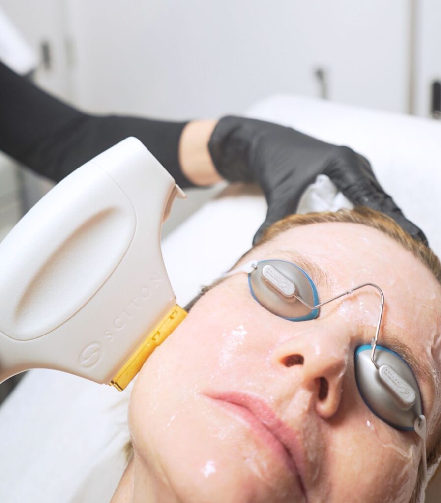 BBL and IPL laser treatments in new york city at hudson dermatology