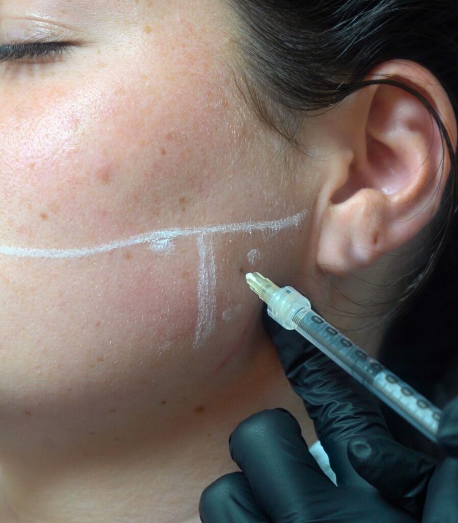 botox injections in masseter jaw muscle in new york city at hudson dermatology