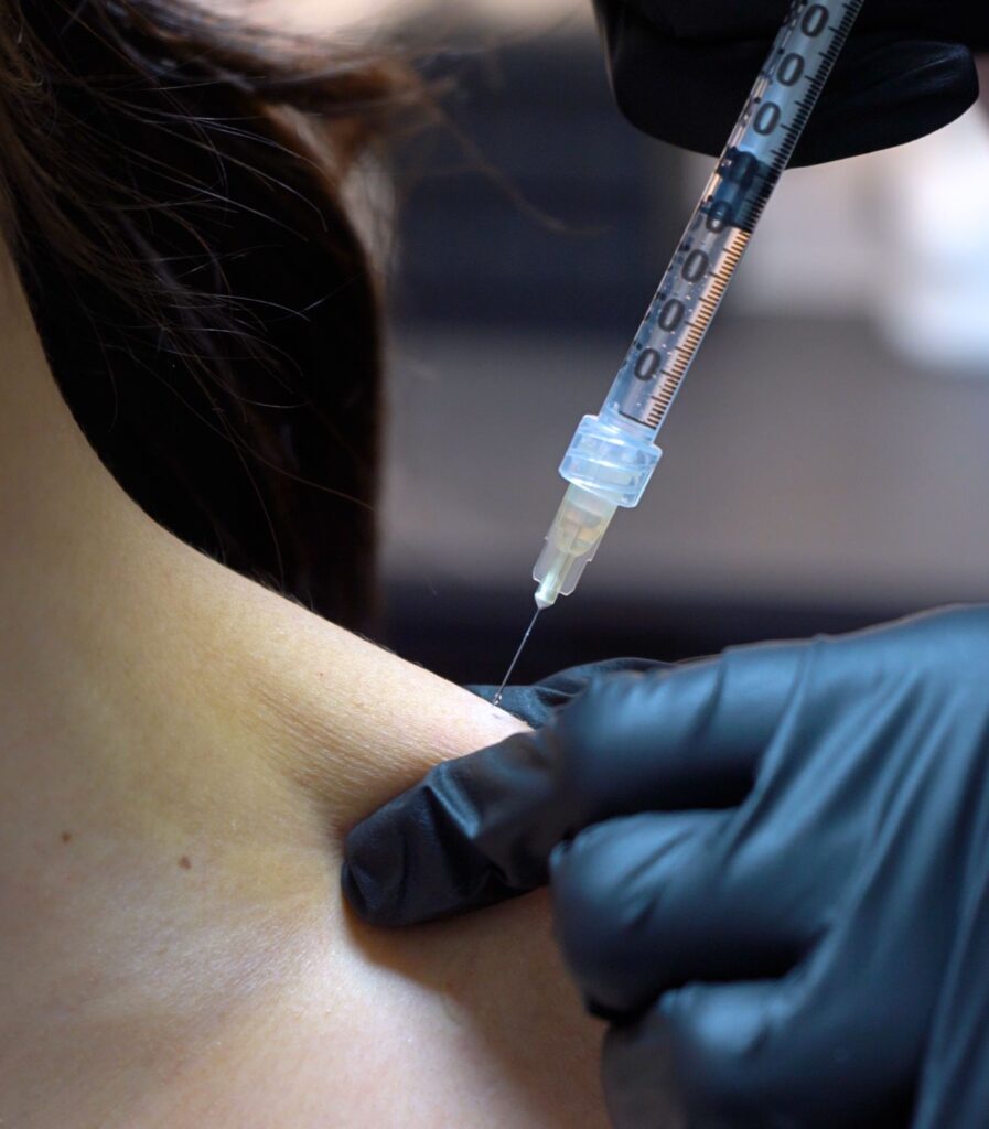trapezius muscle botox injections in new york city at hdls