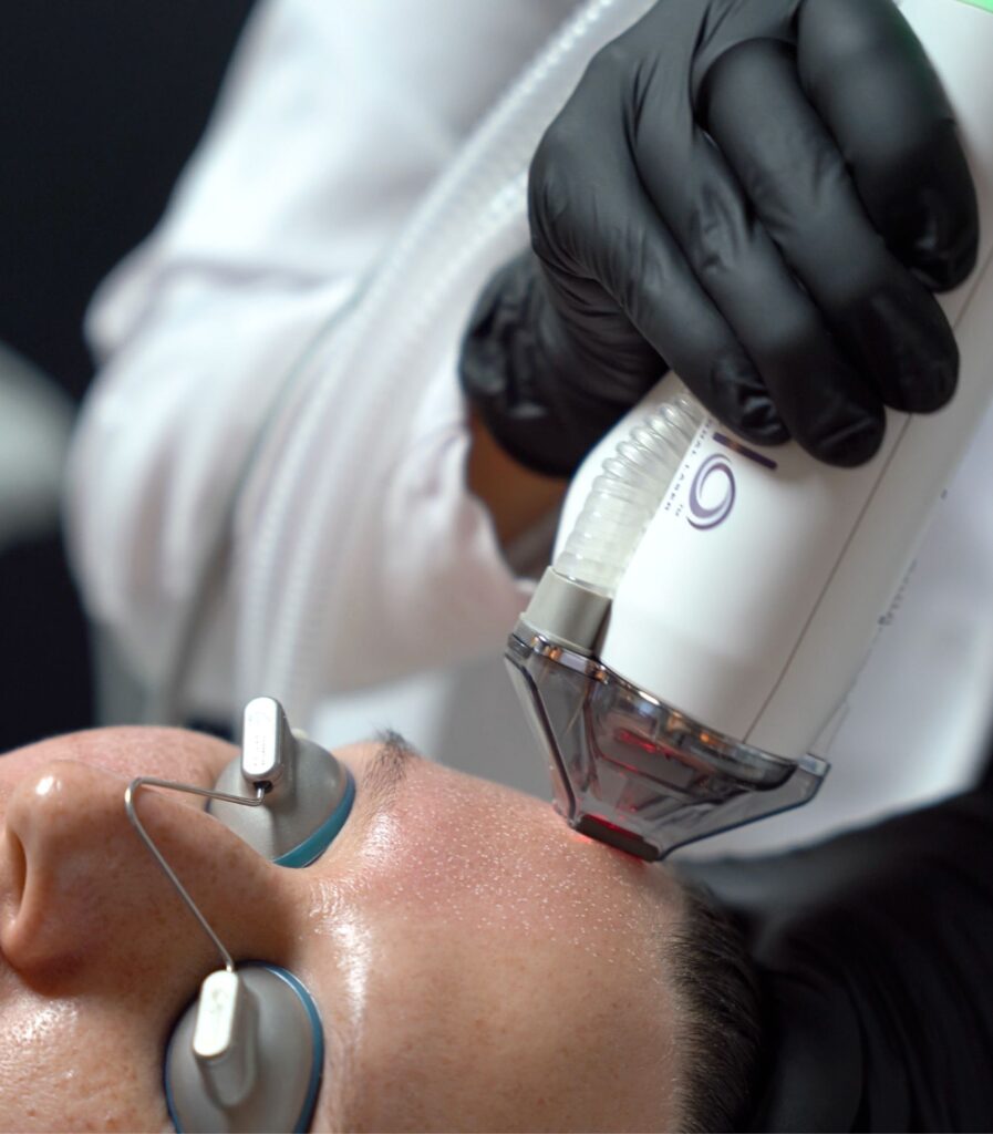 halo laser treatment hudson dermatology new york city