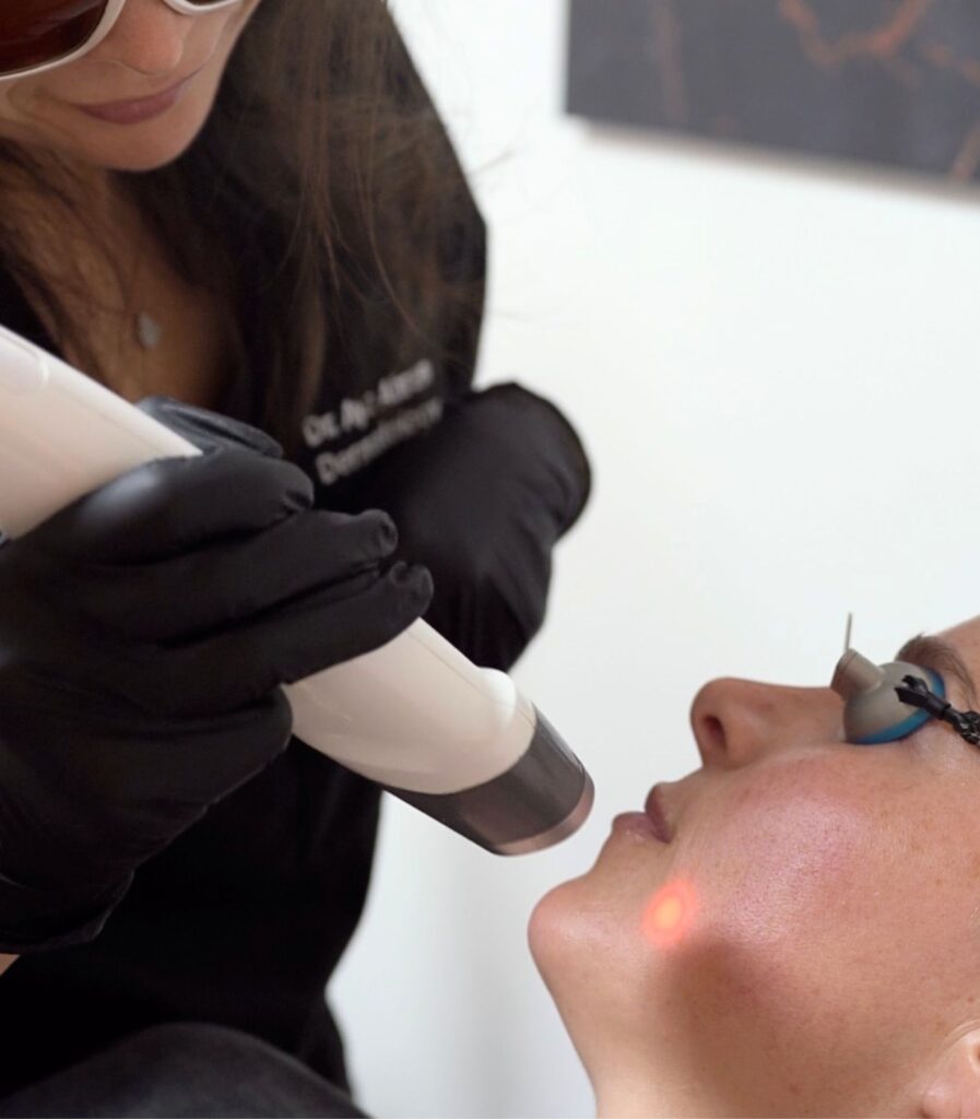 laser genesis and red carpet facial laser treatment in new york city at HDLS