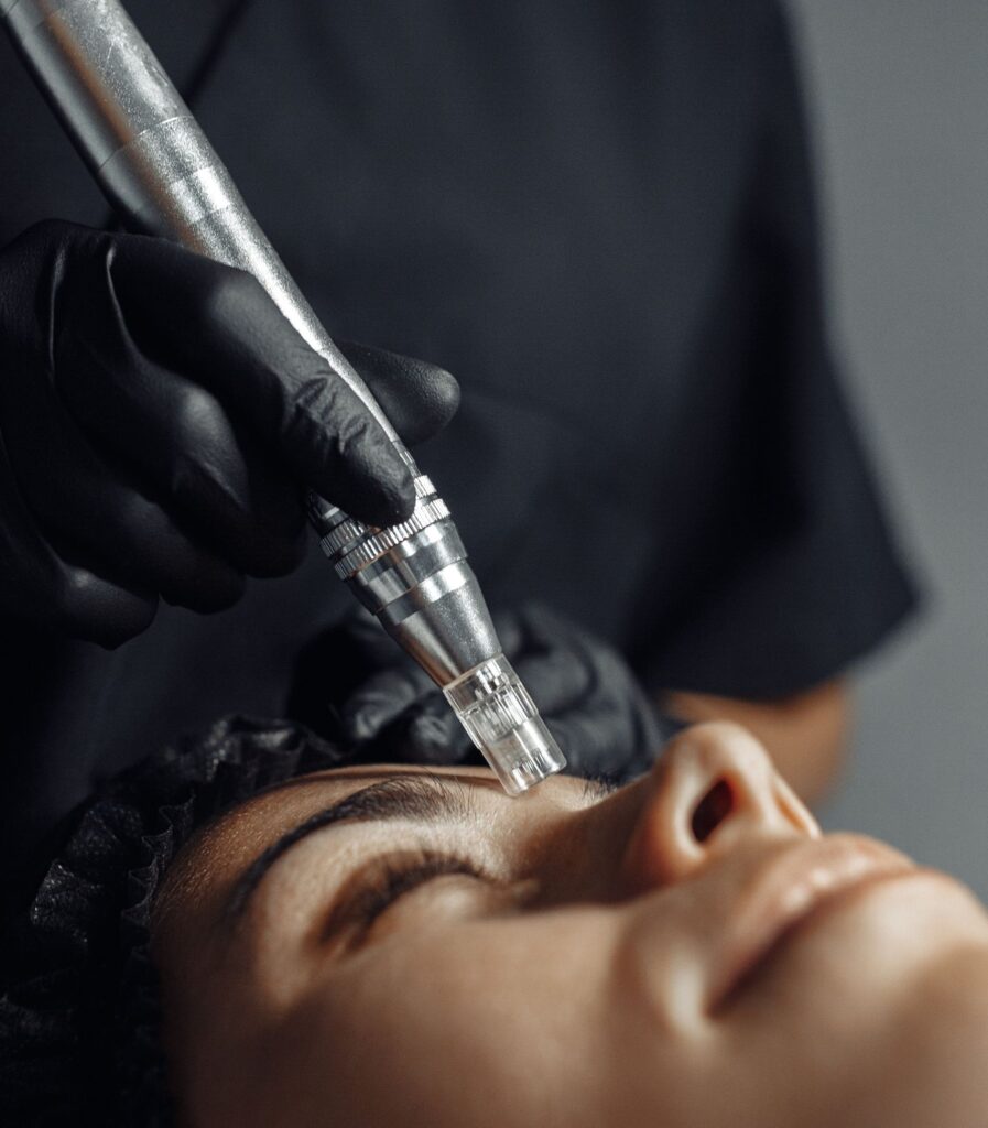 microneedling treatments in new york at hudson derm