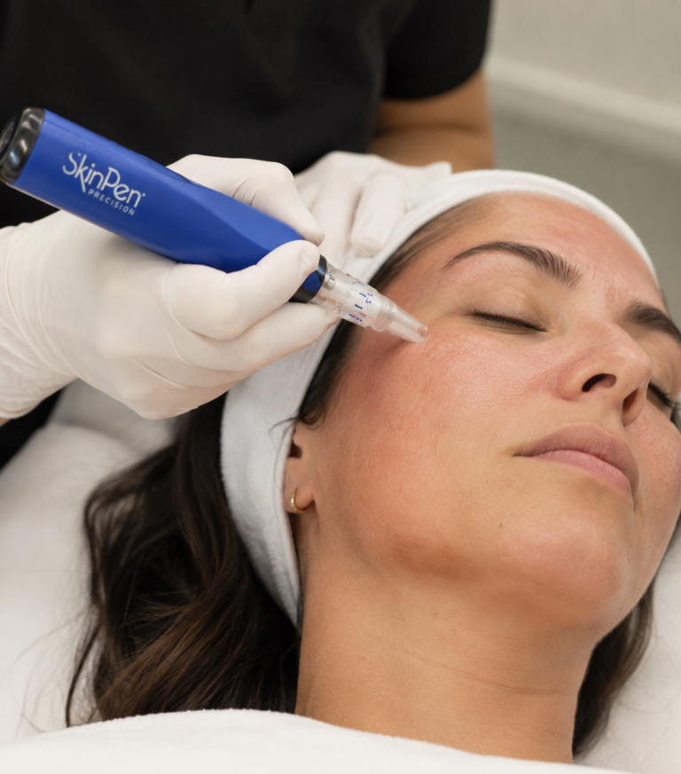 microneedling in new york city at hudson dermatology and laser surgery