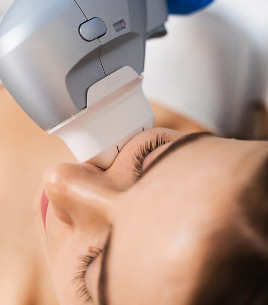 sofwave new york treatment
